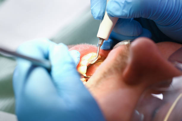 Best Emergency Cosmetic Dentistry in Hazel Park, MI