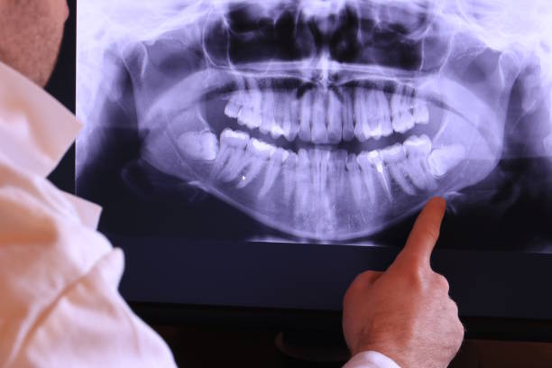Best Emergency Dental Services for Seniors in Hazel Park, MI