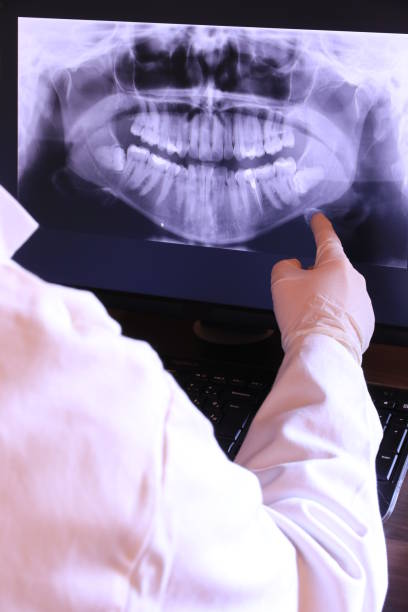 Best Emergency Root Canal Treatment in Hazel Park, MI